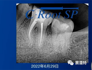 罗紫亮先生案例